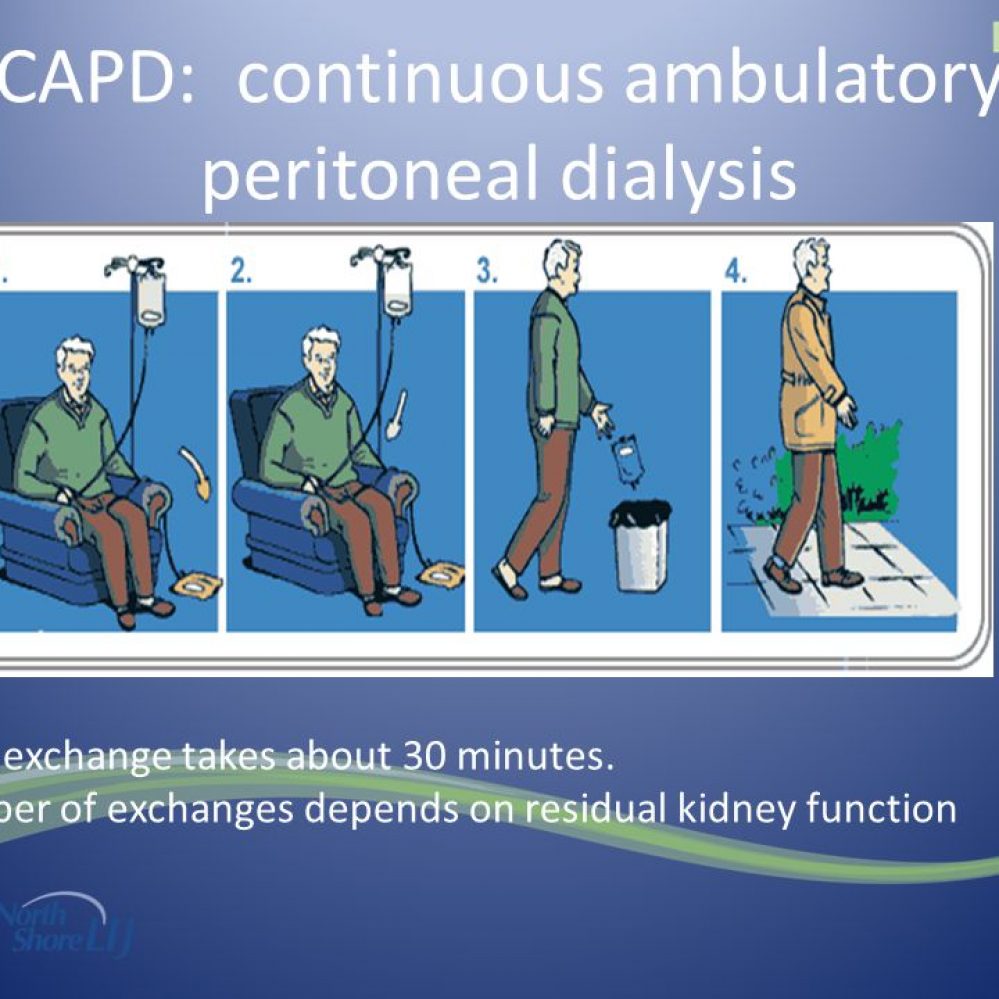 Our Services | National Institute for Nephrology Dialysis & Transplantation